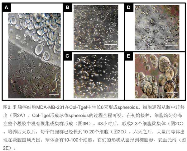 北京唯辉生物技术有限公司 3d细胞培养基质胶 3d coltgel 肿瘤应用